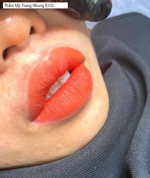 Hình ảnh Thẩm Mỹ Trang Nhung ECG