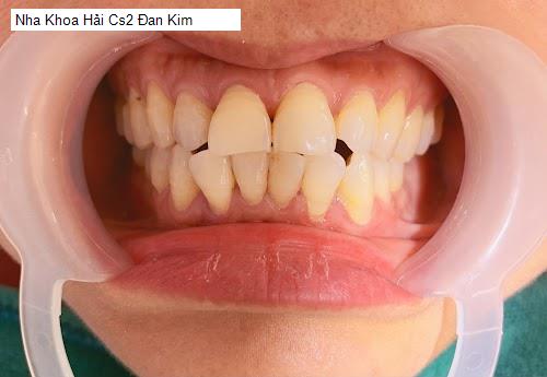 Hình ảnh Nha Khoa Hải Cs2 Đan Kim