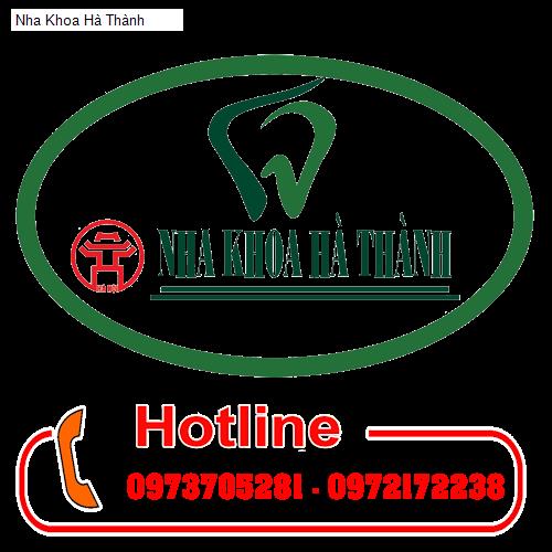 Hình ảnh Nha Khoa Hà Thành